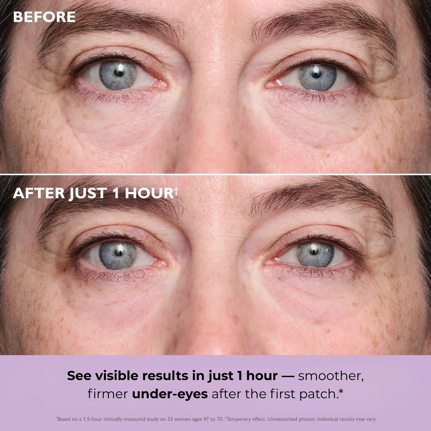 Collagen Infusion Eye Patches