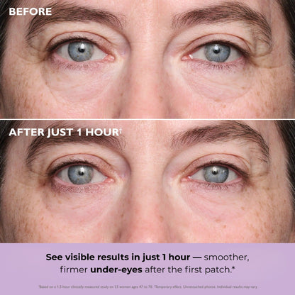 Collagen Infusion Eye Patches